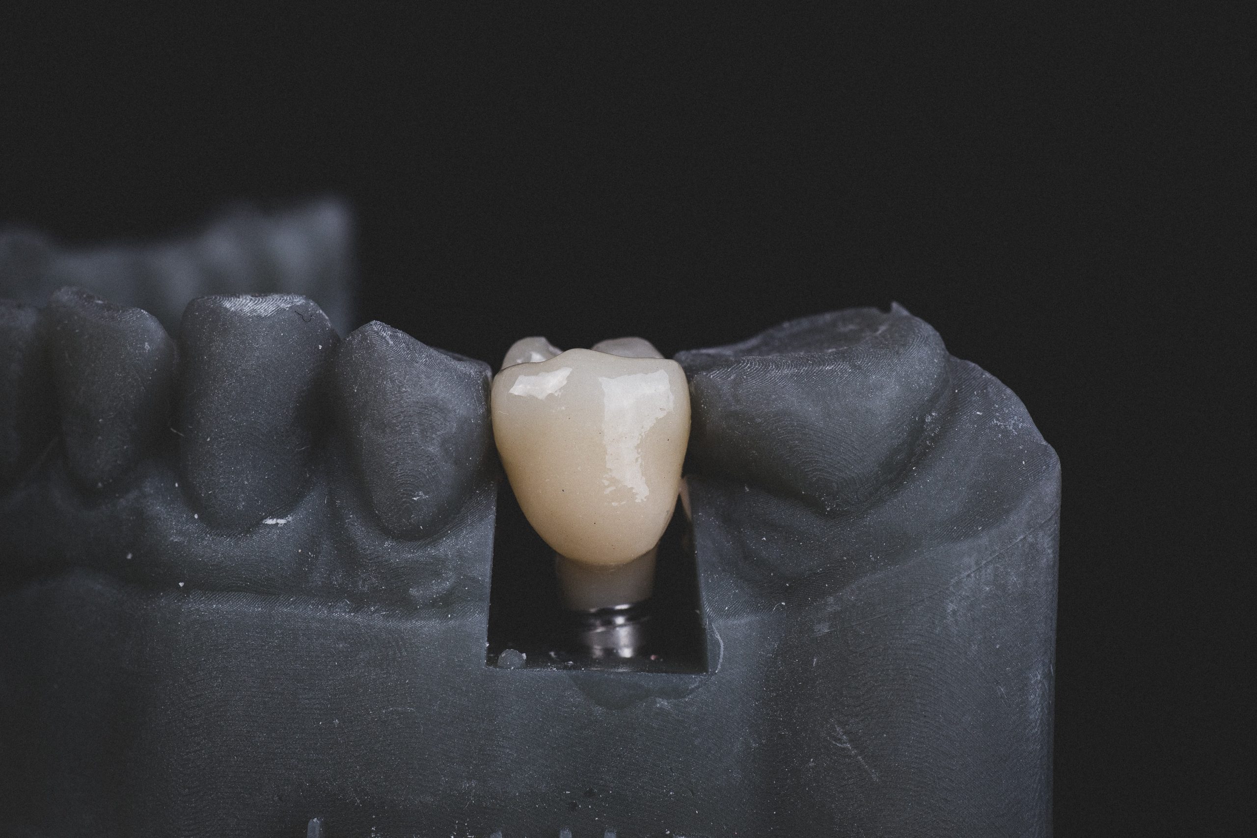 The Complete Guide to Dental Implants: Your Path to a Confident Smile in Lincolnwood, IL