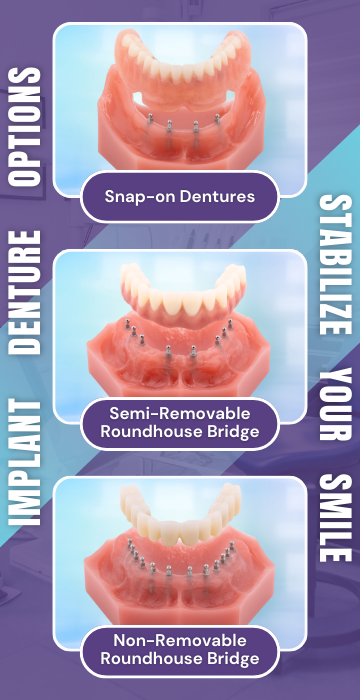 Implant Dentures in Lincolnwood, IL | Stabilize Your Smile With Mini Implants