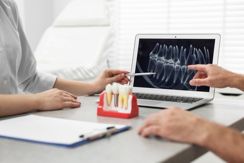 ¿No tienes suficiente hueso para implantes dentales en Lincolnwood, Illinois? Los miniimplantes suelen evitar la necesidad de un injerto